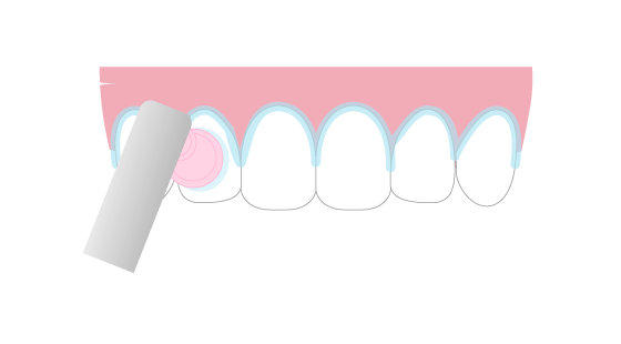 つるつるの歯のイメージ